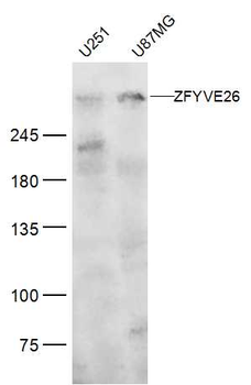 ZFYVE26 Rabbit Polyclonal Antibody