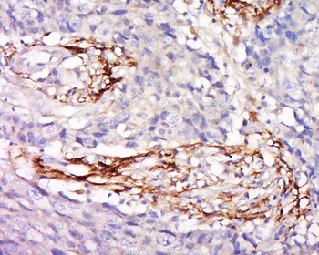 Zinc Alpha 2 Glycoprotein Rabbit Polyclonal Antibody