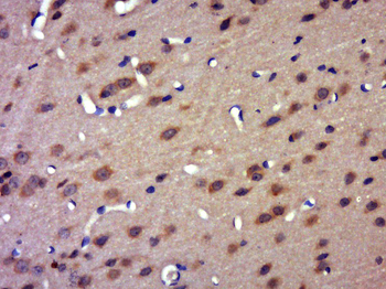 FAM161B Rabbit Polyclonal Antibody