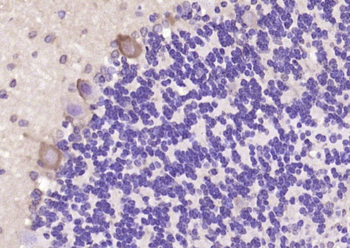 FRMD8 Rabbit Polyclonal Antibody