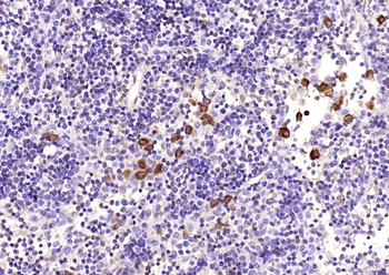 GIMAP1 Rabbit Polyclonal Antibody
