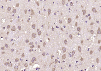 GPRIN3 Rabbit Polyclonal Antibody