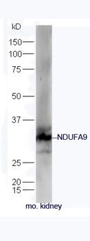 NDUFA9 Rabbit Polyclonal Antibody
