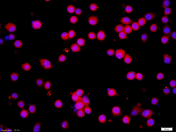 ICMT Rabbit Polyclonal Antibody