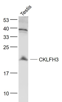 CKLFH3 Rabbit Polyclonal Antibody