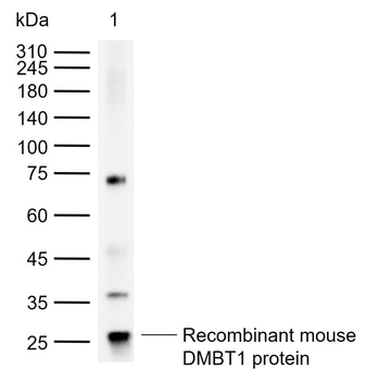 DMBT1 Rabbit Polyclonal Antibody