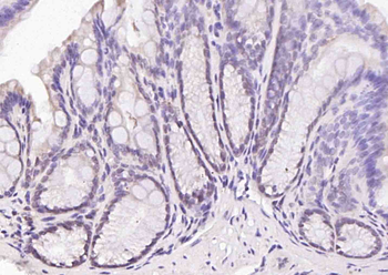 UHRF1 Rabbit Polyclonal Antibody