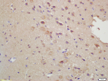FbxO6 Rabbit Polyclonal Antibody