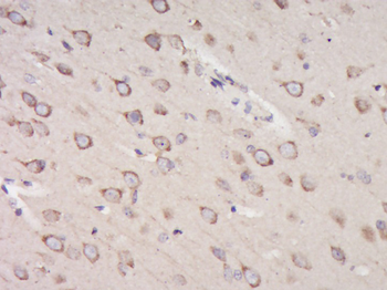 KDEL Rabbit Polyclonal Antibody