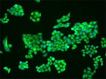 ENC1 Rabbit Polyclonal Antibody