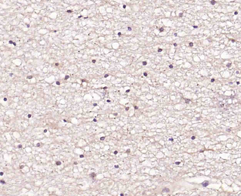 ENC1 Rabbit Polyclonal Antibody