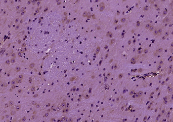 ENC1 Rabbit Polyclonal Antibody