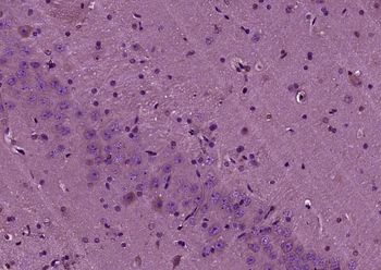 ENC1 Rabbit Polyclonal Antibody