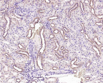 ENC1 Rabbit Polyclonal Antibody