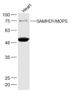 SAMHD1/MOP5 Rabbit Polyclonal Antibody