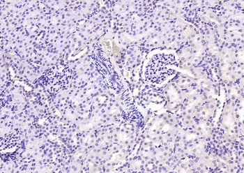 Phospho-PI3 Kinase p110 beta (Ser1070) Rabbit Polyclonal Antibody