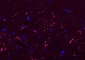 Donkey Anti-Rabbit IgG H&L, BF594 conjugated