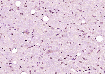 CCDC17 Rabbit Polyclonal Antibody