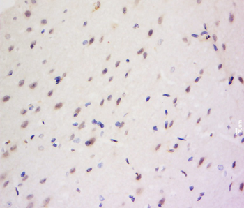 CCDC82 Rabbit Polyclonal Antibody