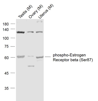 Phospho-Estrogen Receptor beta (Ser87) Rabbit Polyclonal Antibody