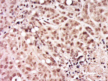 CCDC68 Rabbit Polyclonal Antibody