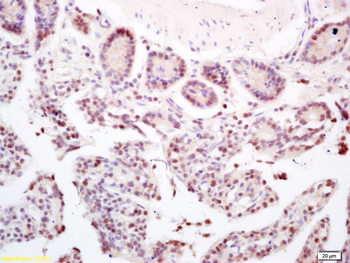 CCDC7 Rabbit Polyclonal Antibody