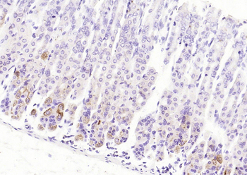 CCDC80 Rabbit Polyclonal Antibody