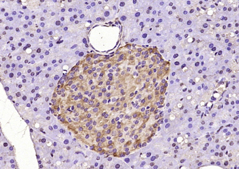 DEPTOR Rabbit Polyclonal Antibody