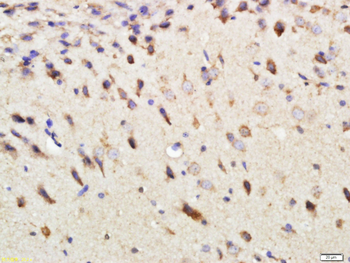 DEPTOR Rabbit Polyclonal Antibody