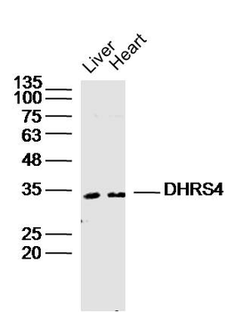 DHRS4 Rabbit Polyclonal Antibody