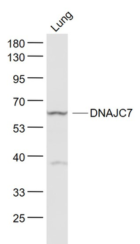 DNAJC7 Rabbit Polyclonal Antibody