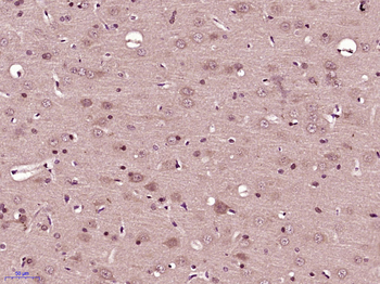 Phospho-CRMP2 (Thr514+Ser518) Rabbit Polyclonal Antibody