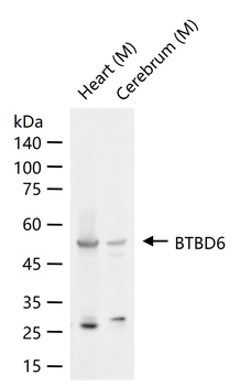 BTBD6 Rabbit Polyclonal Antibody