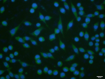 TRP12/TRPV4 Rabbit Polyclonal Antibody