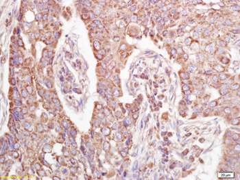 UQCRC1 Rabbit Polyclonal Antibody