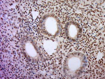 CCDC144A Rabbit Polyclonal Antibody