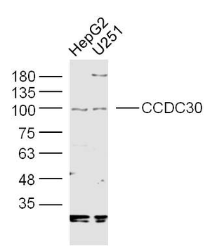 CCDC30 Rabbit Polyclonal Antibody