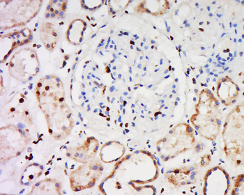 CCDC30 Rabbit Polyclonal Antibody