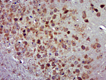CCDC67 Rabbit Polyclonal Antibody
