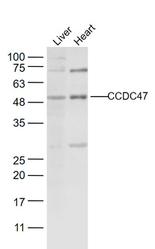 CCDC47 Rabbit Polyclonal Antibody