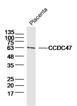CCDC47 Rabbit Polyclonal Antibody
