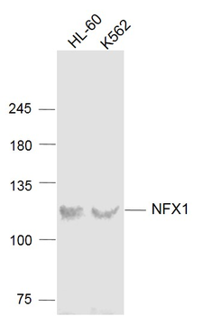 NFX1 Rabbit Polyclonal Antibody