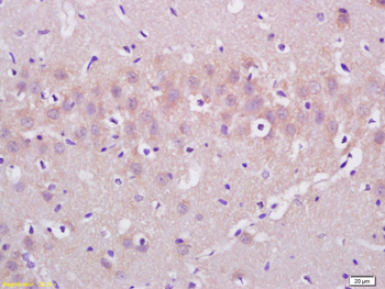 HIP2 Rabbit Polyclonal Antibody