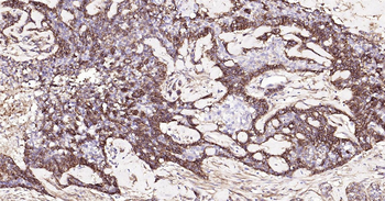 Human Integrin beta 1 Ready-To-Use IHC Kit