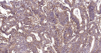 Human Integrin beta 1 Ready-To-Use IHC Kit