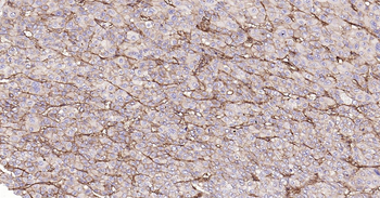Human Integrin beta 1 Ready-To-Use IHC Kit