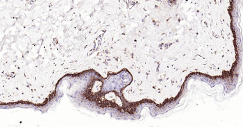 Human Integrin beta 1 Ready-To-Use IHC Kit