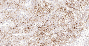 Human CD138 Ready-To-Use IHC Kit
