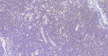 Human CD25 Ready-To-Use IHC Kit