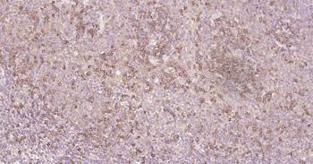 Human CD25 Ready-To-Use IHC Kit